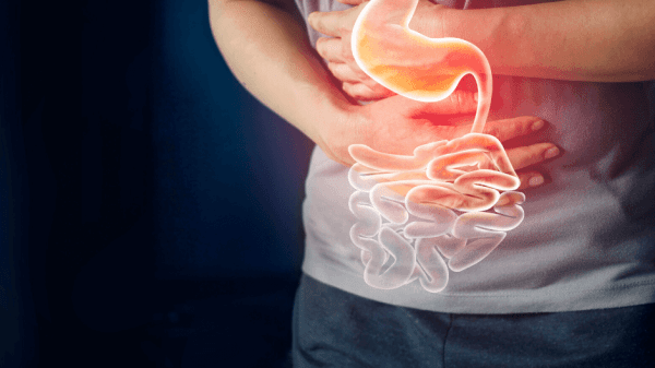 Mann hält sich vor Schmerzen den Bauch und schematische Darstellung des Verdauungstraktes.