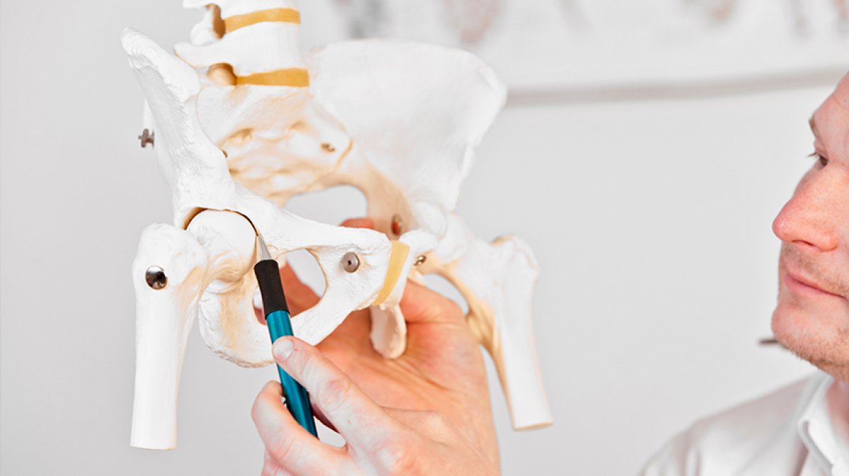 Anatomisches Modell des Hüftgelenks zur Veranschaulichung einer Hüftoperation und Behandlung.