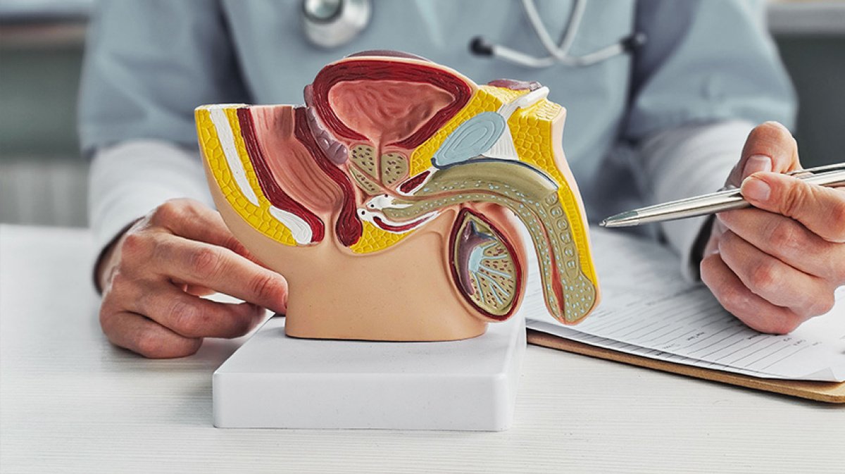 Anatomisches Modell veranschaulicht eine Prostataoperation und deren medizinische Behandlung.